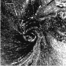 Le Shiatsu - Connective Tissue Whirlpool Image